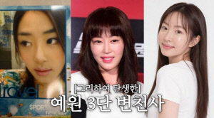 강예원 "코 수술에 눈만 7번, 성형 지긋지긋해"…앞트임 복원 후 털어놓은 속마음