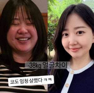 '박수홍♥' 김다예, -38kg 얼굴 차이에 깜짝 "눈 작아지고 코 커져"