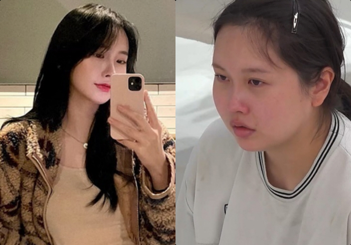 Wife Gained 30 kg After Giving Birth, Suspected Postpartum Depression... 'I Don't Want to Raise the Child,' Blames Husband on 'Marriage Hell'