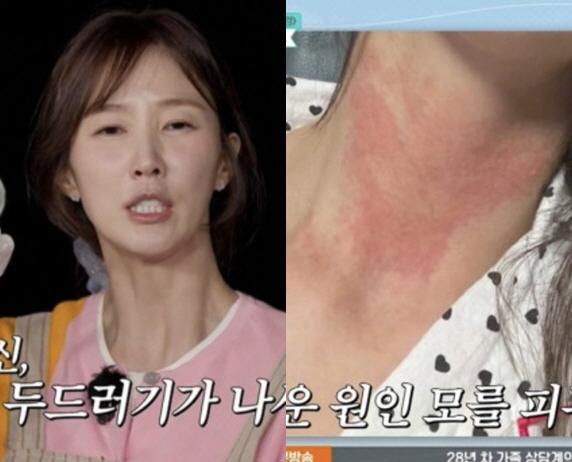 "전신 두드러기에 대인기피증까지" 이수경, 은퇴까지 고민했던 가슴 아픈 속사정