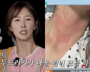 "전신 두드러기에 대인기피증까지" 이수경, 은퇴까지 고민했던 가슴 아픈 속사정