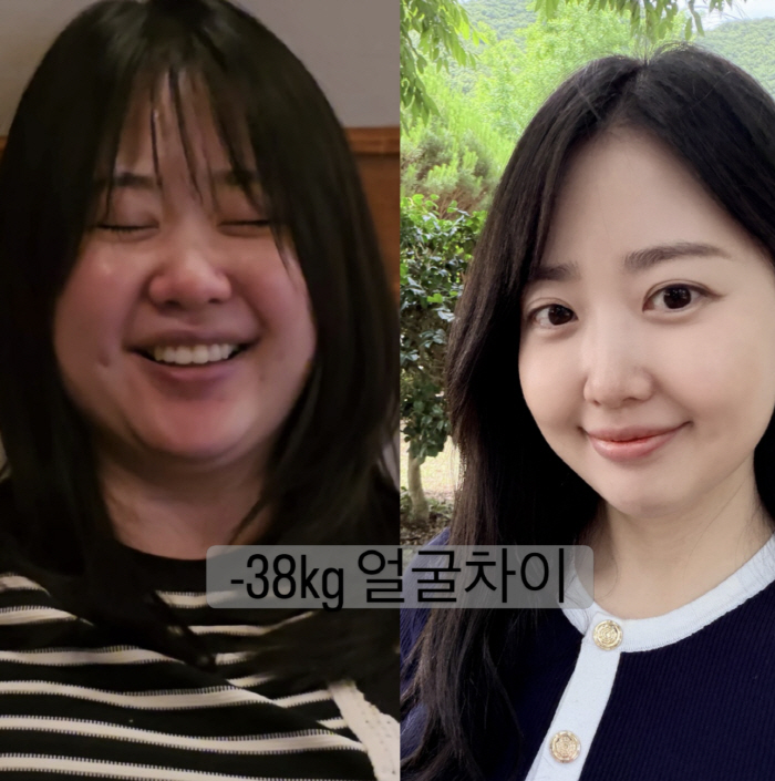 Park Soo-hong's Wife Kim Da-ye Draws DM Asking if She Was in a 'Fat Suit' During Her 90-Kg Days