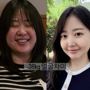 '박수홍♥' 김다예, 90kg 시절 어떻길래.."뚱녀 분장 했냐" DM까지