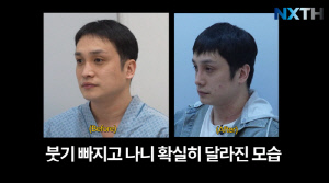 '제아 출신' 김태헌, '코 성형' 후 확 바뀐 얼굴.."페이스 인식 불가"