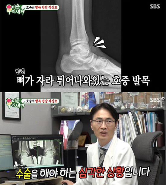 "Early Release" Kim Ho-joong to Head for Surgery Rather Than the Stage: "A Rattling Sound From His Ankles"