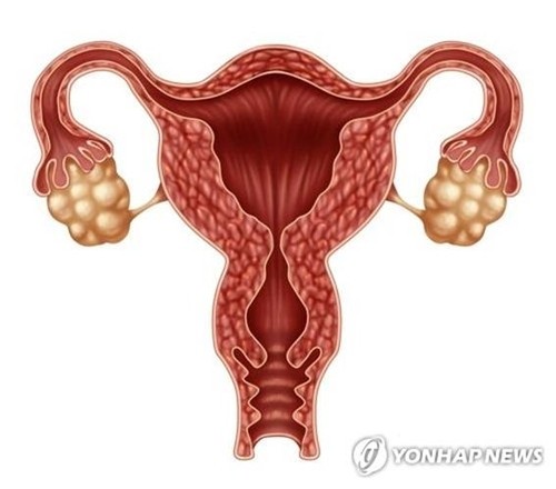 [소셜＋] 47㎏ 환자에게 "살 빼라" 그만…14년만에 이름 바뀐 이 질환