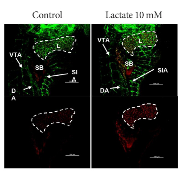 A New Treatment for Metabolic Dysfunction-Associated Fatty Liver Disease Was Found in Lactate