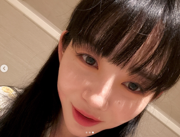 권민아, '슈링크 화상' 6개월 만 근황..얼굴 흉터 그대로 '안타까워'