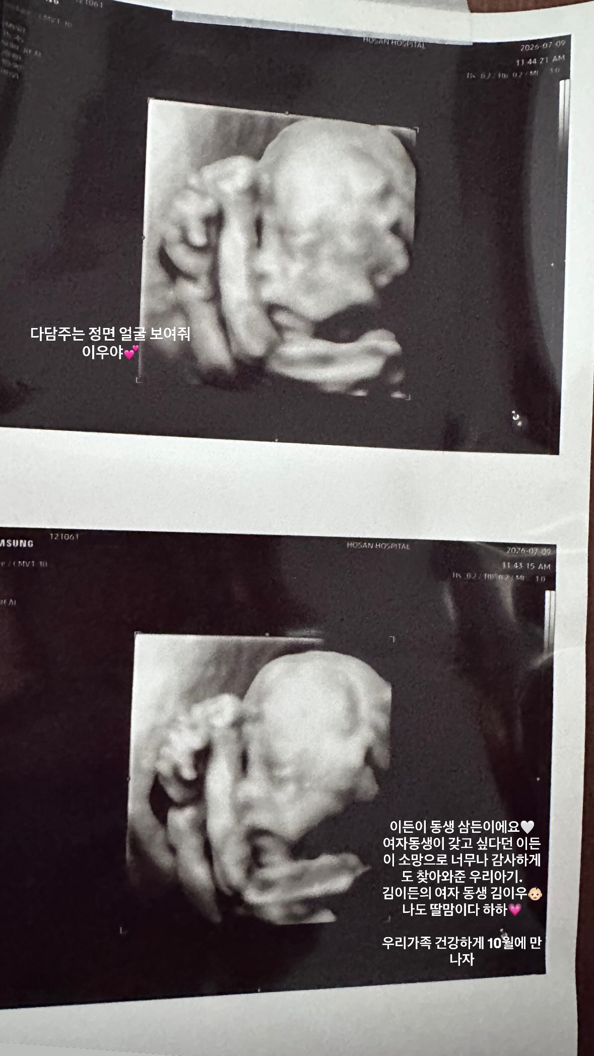 '지드래곤 누나' 권다미, 43세에 둘째 임신 "감사하게 찾아와, 10월 출산"[공식]