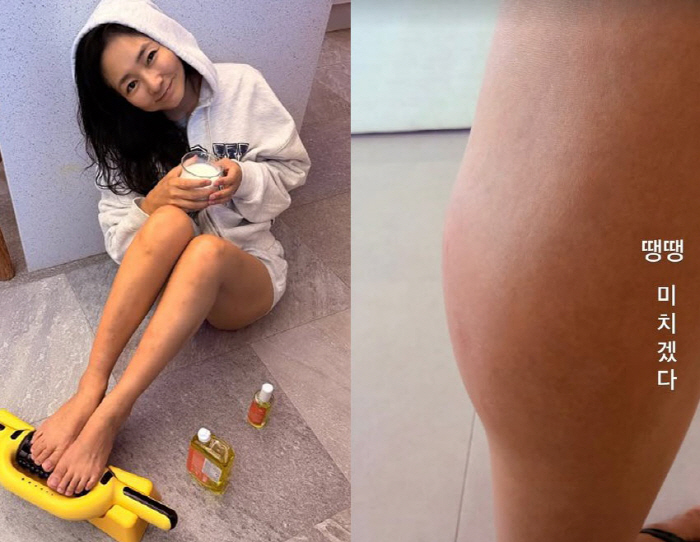 Jin Jae-young shows clear bite marks after centipede attack 'My calf is so swollen it feels like it could burst'