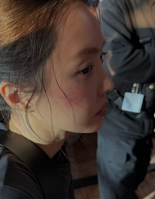 Son Na-eun of 'Mr. Kim' Was Once the 'YG Princess'... Bruises on Her Face and a Bloodied Knife Send Chills
