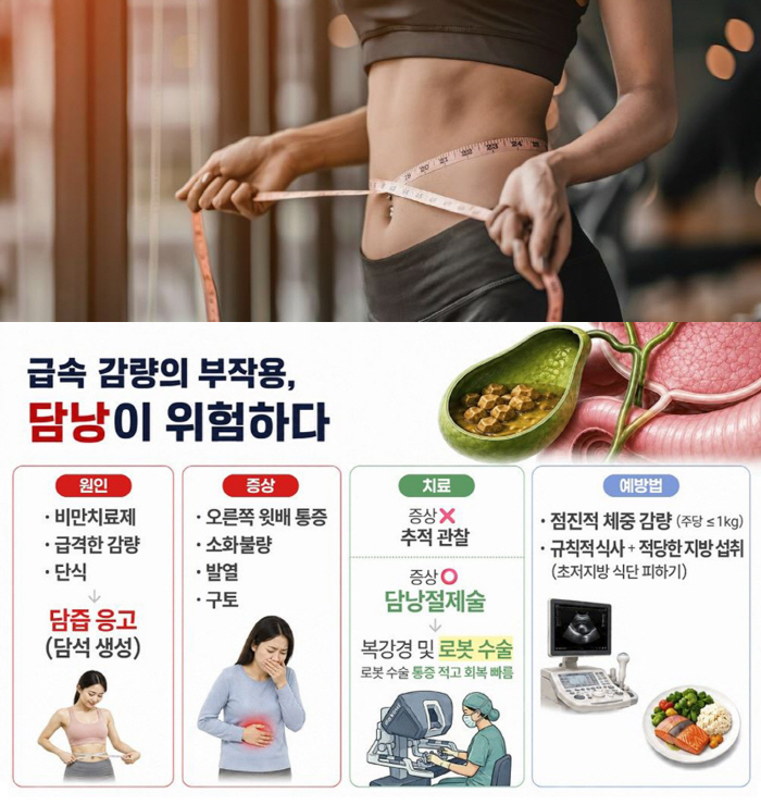 Rapid Weight Loss Threatens Gallbladder Health... Gallstone Rates Are Twice as High in Women as in Men