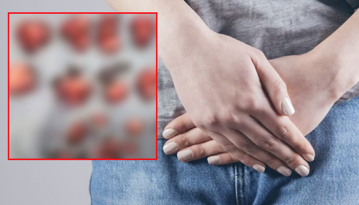 'I Thought I Was Pregnant...' Woman in Her 40s Found to Have 50 Uterine Fibroids