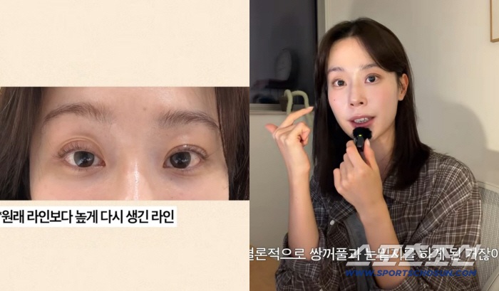 'Heart Signal 4' Lee Joo-mi Opens Up About Double Eyelid and Under-Eye Surgery, Says She Often Heard, 'Your Eyes Look Different'