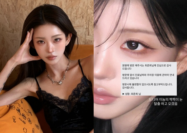 '故 최진실 딸' 최준희, 친구들 만류에도 또 성형수술 예약..."짝짝이 눈 탈출하겠다"