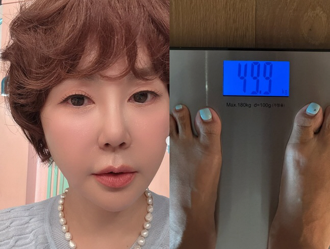 Hwang Hye-young, Who Revealed Her Brain Tumor Battle, Has Lost So Much Weight She Looks Like a Different Person... Enters the 40-Kilogram Range, 'Finally, the First Digit Changed'