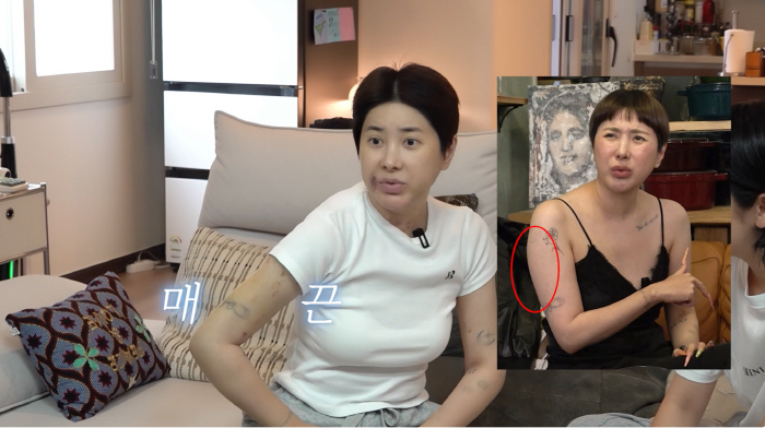 Seo In-young Undergoes General Anesthesia... Changes After Arm Liposuction 'I Came Back From the Brink'