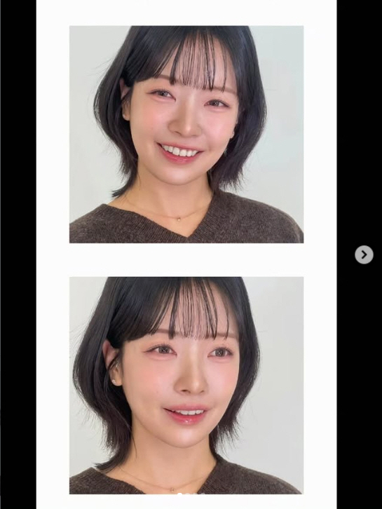 '뒷담화 논란' 31기 영숙, 확 달라진 얼굴…"광고 아닙니다"