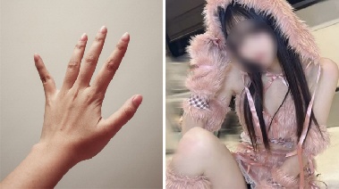 “다른 여자와 결혼 못 해”…남자친구 약지 절단한 여성, '그것'도 잘랐다