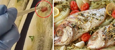5cm 길이 생선가시 삼킨 남성 끝내 숨져, 사망 원인은?
