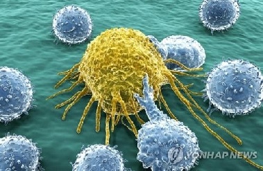 한 번 검사로 여러 암 포착…'다중 암 조기진단' 주목