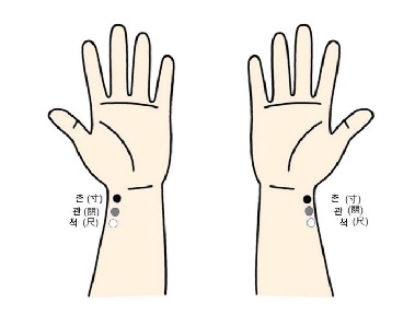 아픈 곳 '반대편'에 침 놓는 이유, 과학적 근거 나왔다