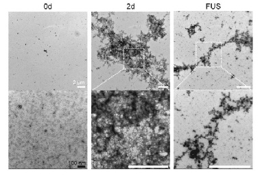 “약물 없이 초음파로 알츠하이머 원인 물질 65% 제거”