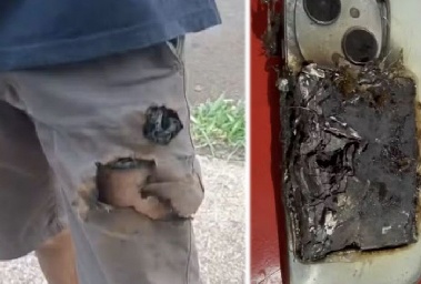 “주머니 속 휴대폰 폭발해 살았다” 이렇게 황당한 일이?