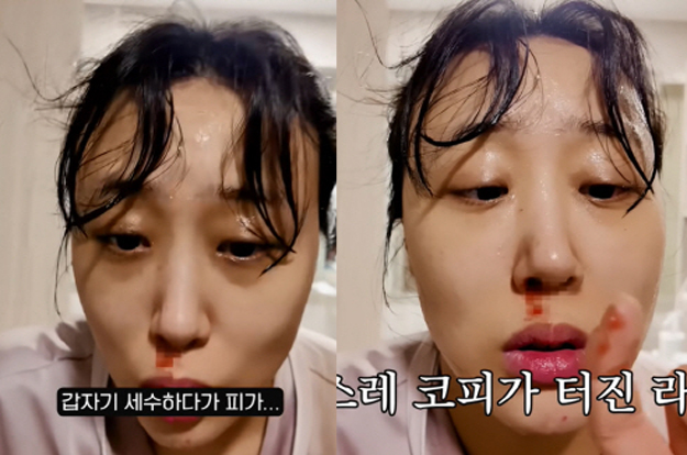 '난임극복' 임라라, 얼굴 피범벅에 경악 “임신 증상이 맞나요?”