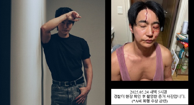 배우 전호준, 전여친 폭행 주장 정면 반박..“살려주세요” 핏자국 선명한 사진 공개
