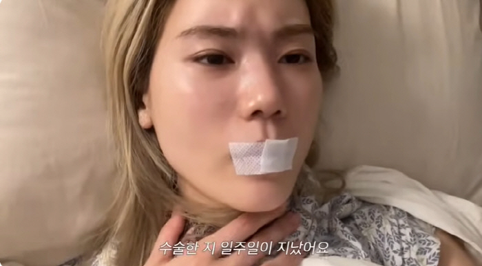 씨야 김연지, 안타까운 투병 근황 “한 달 넘게 목소리 못 내”