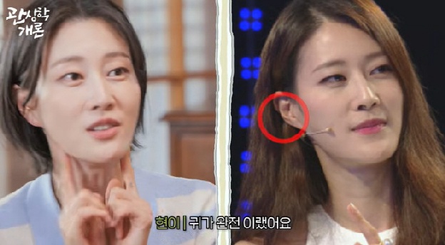 이현이, 귀 필러 고백 “돈 줄줄 샌다는 말에 시술, 효과 있어”