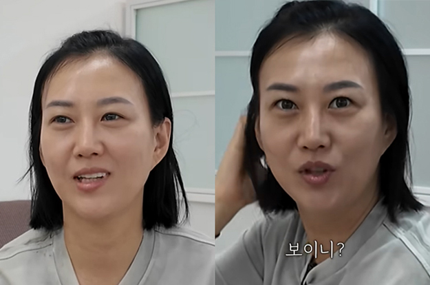 장윤정, 솔직 고백 “눈 시술 받았다”..더 커진 눈매