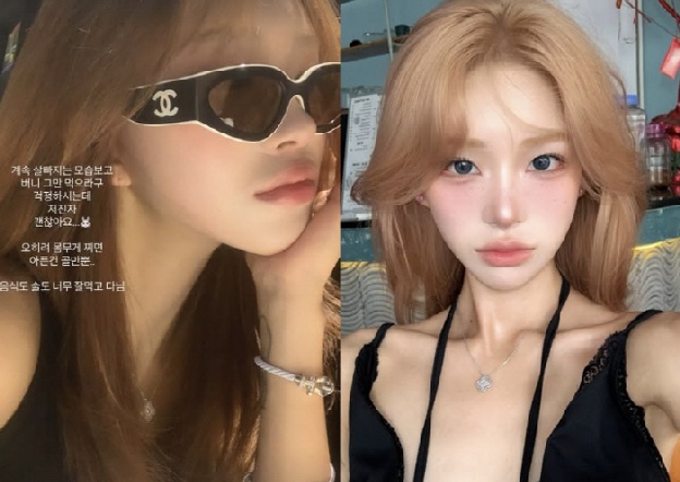 '故 최진실 딸' 최준희, 41kg '계속 빠지는 살'에 주변 걱정 쏟아져..“오히려 찌면 아파”