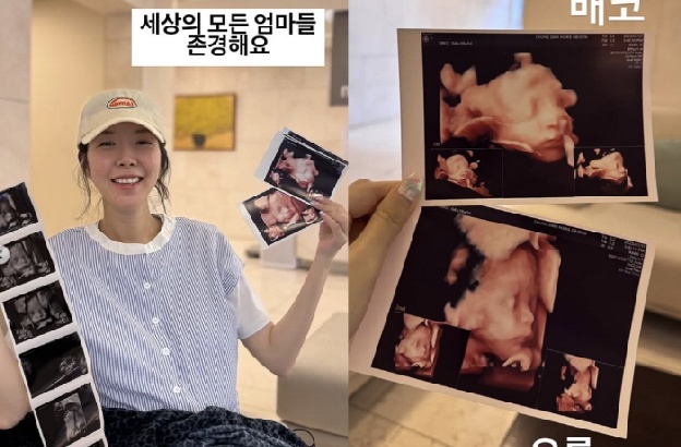 '쌍둥이 임신' 김지혜, 입체초음파 안타까운 소식 “미안해 아빠가..나 닮아서 그래”