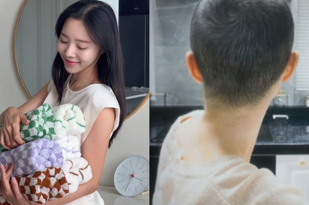 암세포 사라진 이솔이, 눈부신 회복력..삭발 후 풍성해진 머리숱 “수고했다, 나”