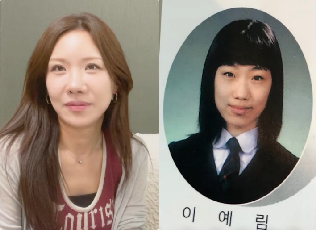'성형만 13번' 연예림 “외모 자격지심에 눈 8번, 코 3번, 가슴+윤곽..지금도 예쁘지 않아”