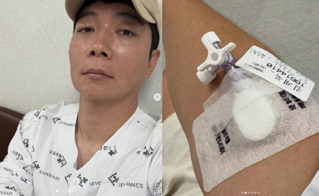 “얼굴 50바늘 꿰맸다” 김재욱, 동생 3번째 암수술 이어 추석에 또 눈물