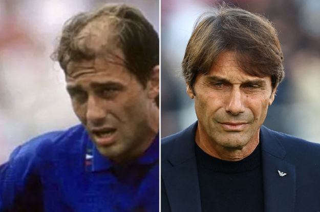 “토트넘 탈모라인,머리숱 자신감 장착!” 세계 최대 튀르키예 모발이식 클리닉과 사상 첫 파트너십 계약