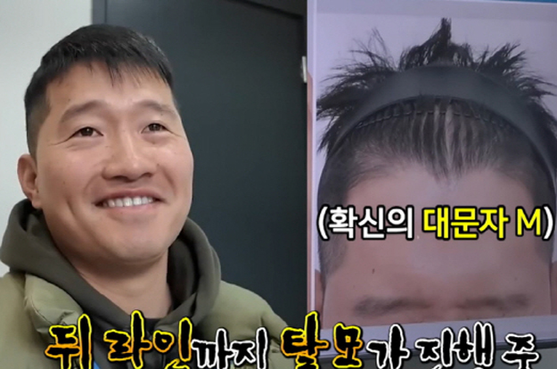 강형욱 '갑질 논란 여파' 앞탈모 생겼다..“주사 치료+흑채로 숨겼다”