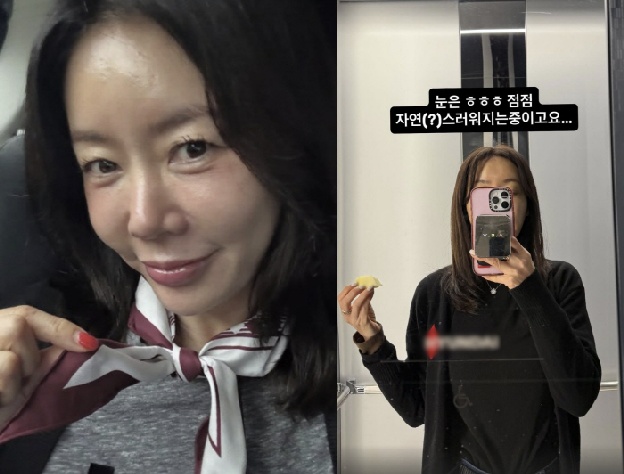 '49세' 안선영, 쌍꺼풀 수술 만족 “점점 자연스러워지는 중”