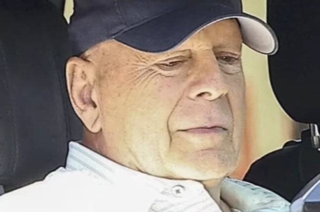 치매 투병 유명 배우 ‘뇌’, 결국 해부대에..“연구 위한 기증”