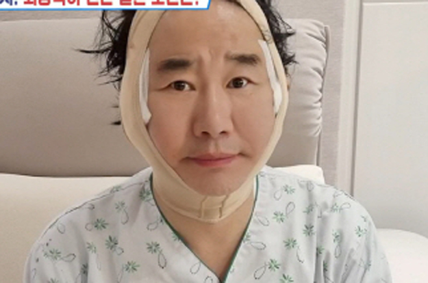 '64세' 최양락, 성형 후 붕대 감고 부은 얼굴..“안면거상+쌍꺼풀+모발이식 했다”