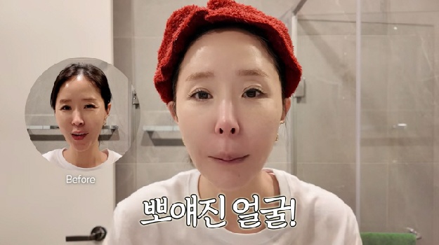 '5월 결혼' 신지, 얼굴 완전히 달라졌다..'비포 애프터 영상' 공개 “티가 나”