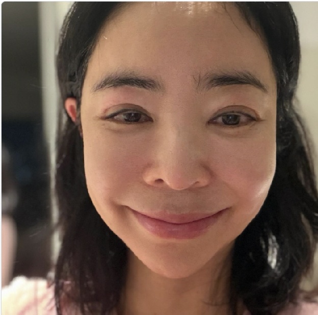 이혜영, 폐암·담석증 이어 또...안타까운 근황 “림프 염증 좀 가라앉아”