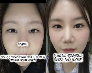 '미스터 킴♥' 28기 순자, 앞트임까지 했다..7일만 '확 달라졌다'