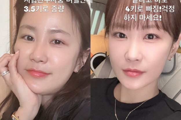 “얼굴 또 바뀌었네” 김지민, 시험관 주사에 턱선 실종 '퉁퉁'..급격한 변화 깜짝