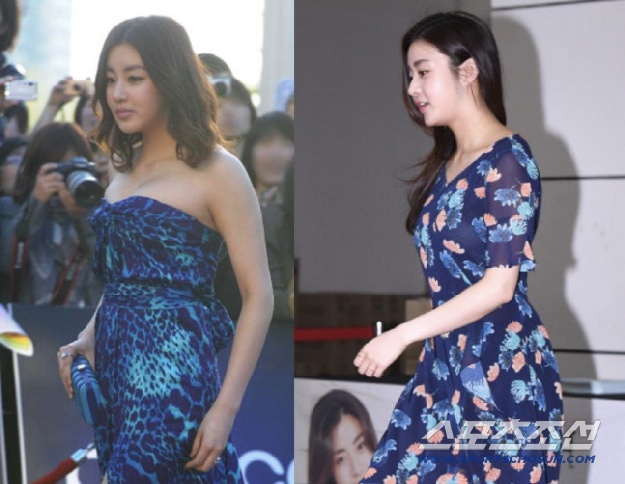 '한의사♥' 강소라, 거북목 고친 뜻밖의 비결 “클래식 음악 들으니 자세 바뀌어”