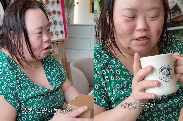 '다운증후군' 정은혜, “왜 제 남편을 혼내요!” 울컥..'발달장애' 조영남 타박에 발끈