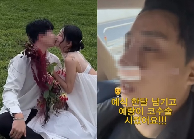 '최진실 딸' 최준희, ♥예비 남편 코성형 시켰다 “나랑 같은 원장님, 사랑하면 닮는다”